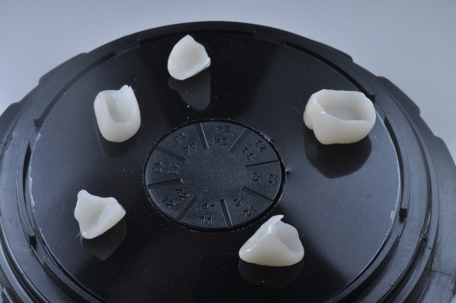 Carillas de porcelana individuales antes de su colocación