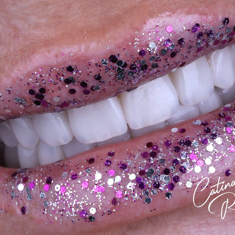 Fotografía dental artística Málaga
