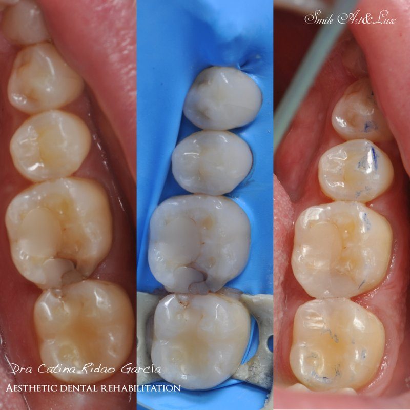 Odontología general en Málaga, clínica boutique dental